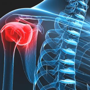 Lesões e o tratamento com auxilio da nutrição